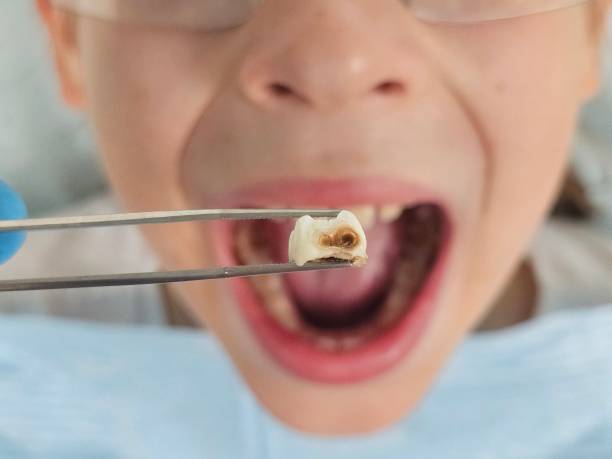 Best Emergency Dentist for Special Needs Patients in Rockingham, NC